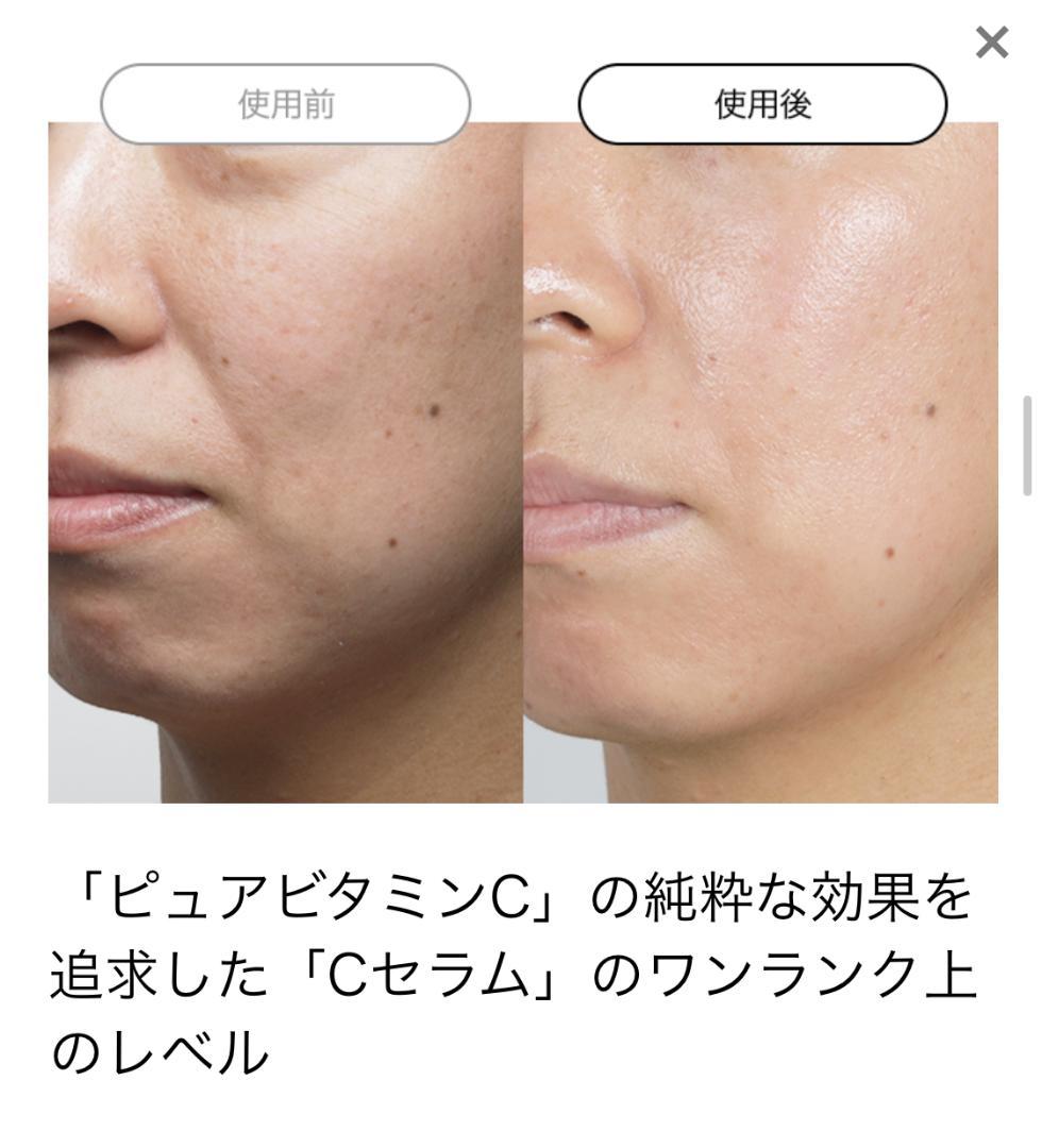 ビーグレンVC5・VA5・HQ5＋リセットマスク付。最高濃度レベル5の美容液