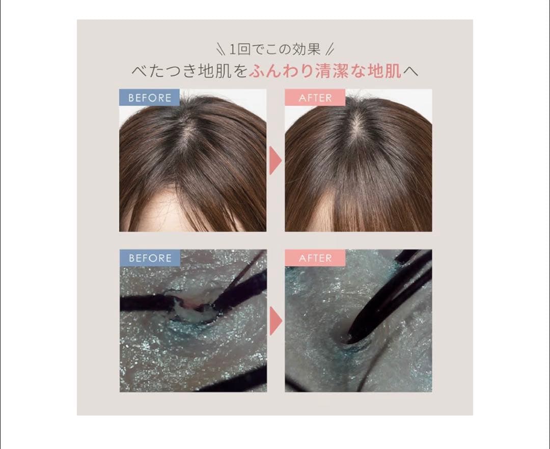 mysé MS-31 美顔器 本体 ゴールド 美品
