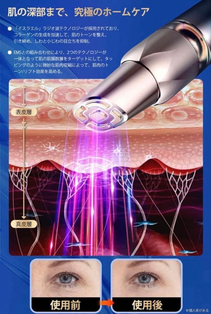 新品 CICLEY RF EMS 目元美顔器 3in1 アイケア たるみ クマ