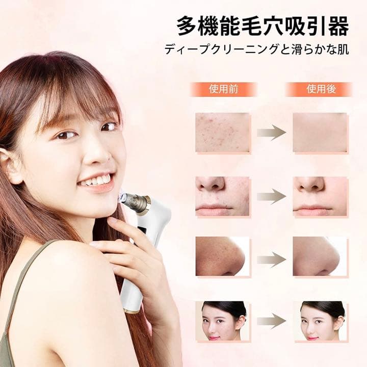 最強美顔器2点セット⭐️ エステ級 毛穴ケア ピーリング  多機能 美顔器 EMS