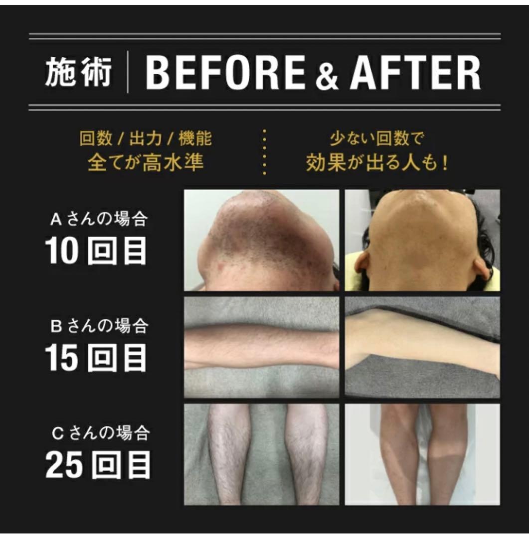 (新品未開封)定価の半額以下で家庭用脱毛器出品致します！