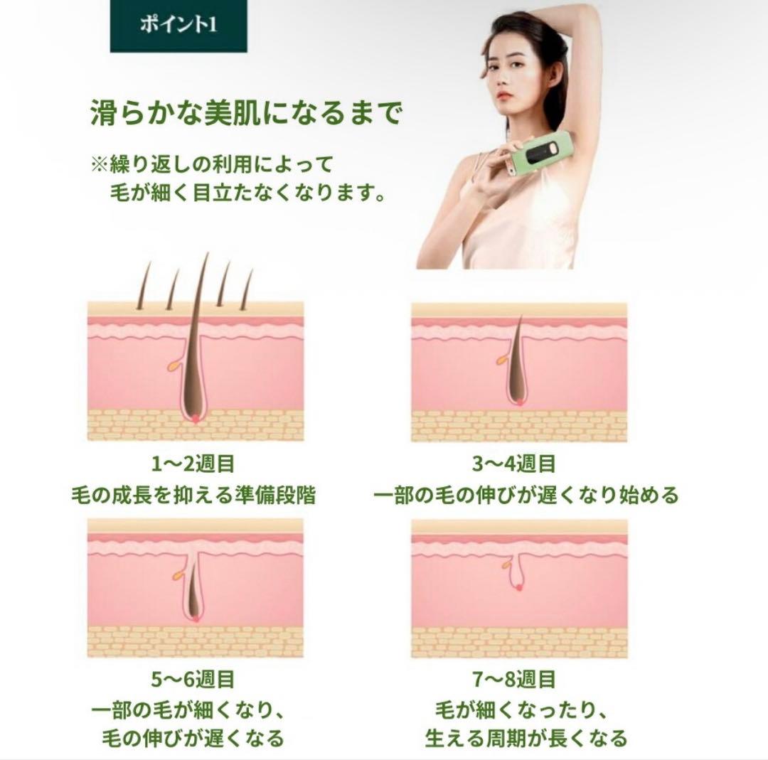 脱毛器 IPL脱毛器 無制限 無制限回照射 脱毛家庭用脱毛機