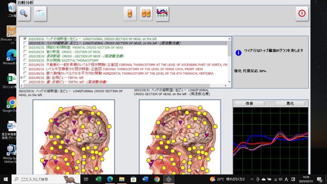 完全和訳版　メタ・ハンター（メタトロンタイプ）タブレット付き！