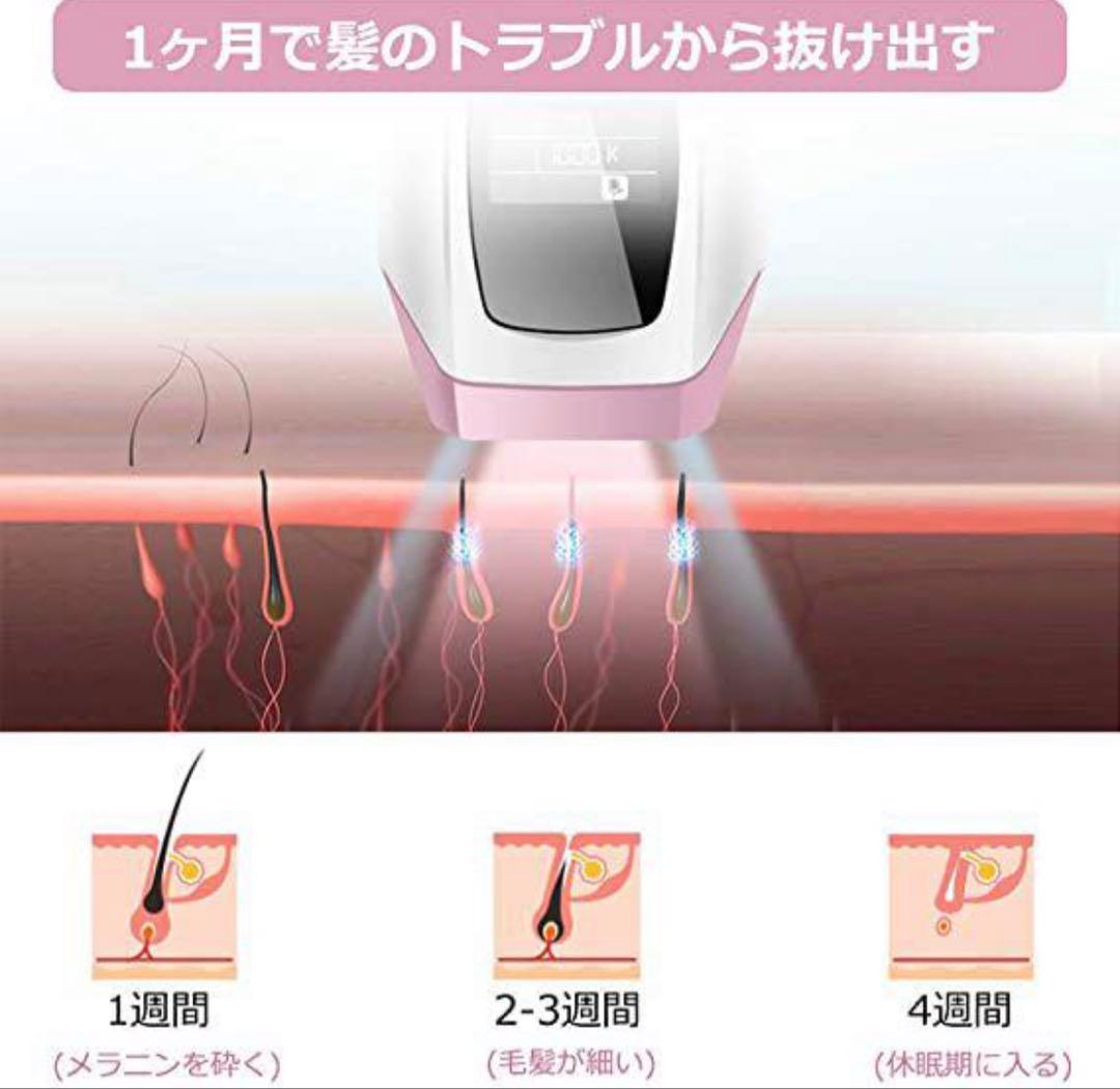脱毛器　　永久脱毛