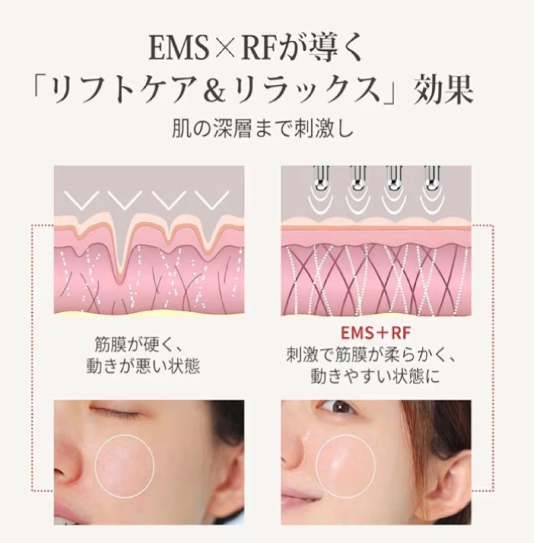 ANLAN ダブルポインター 美顔器
