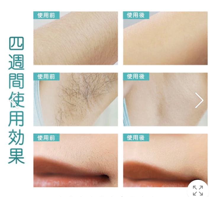 taqisong 脱毛器 サファイア 冷却機能 冷却脱毛 IPL 99万発