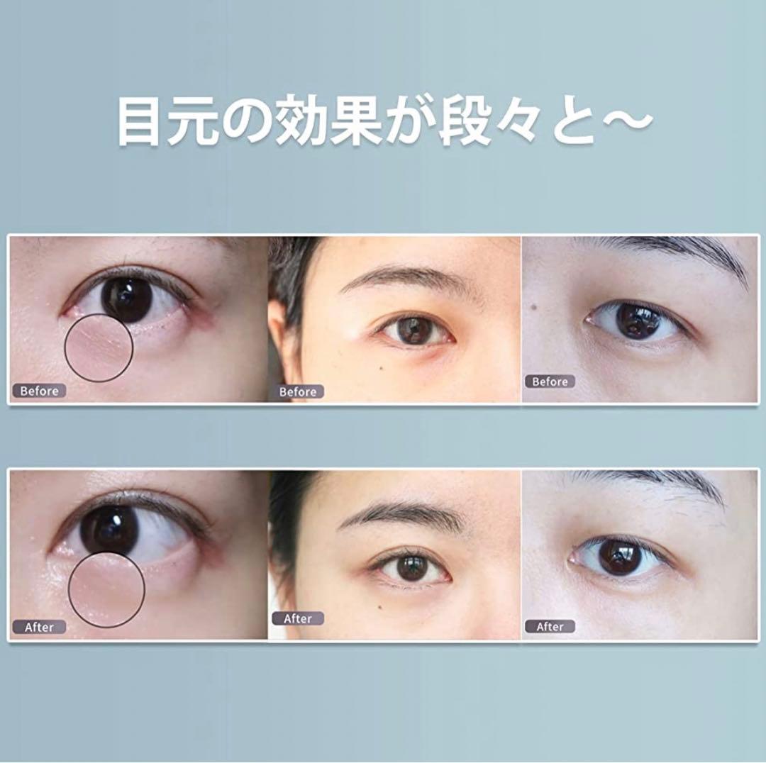 目元美顔器