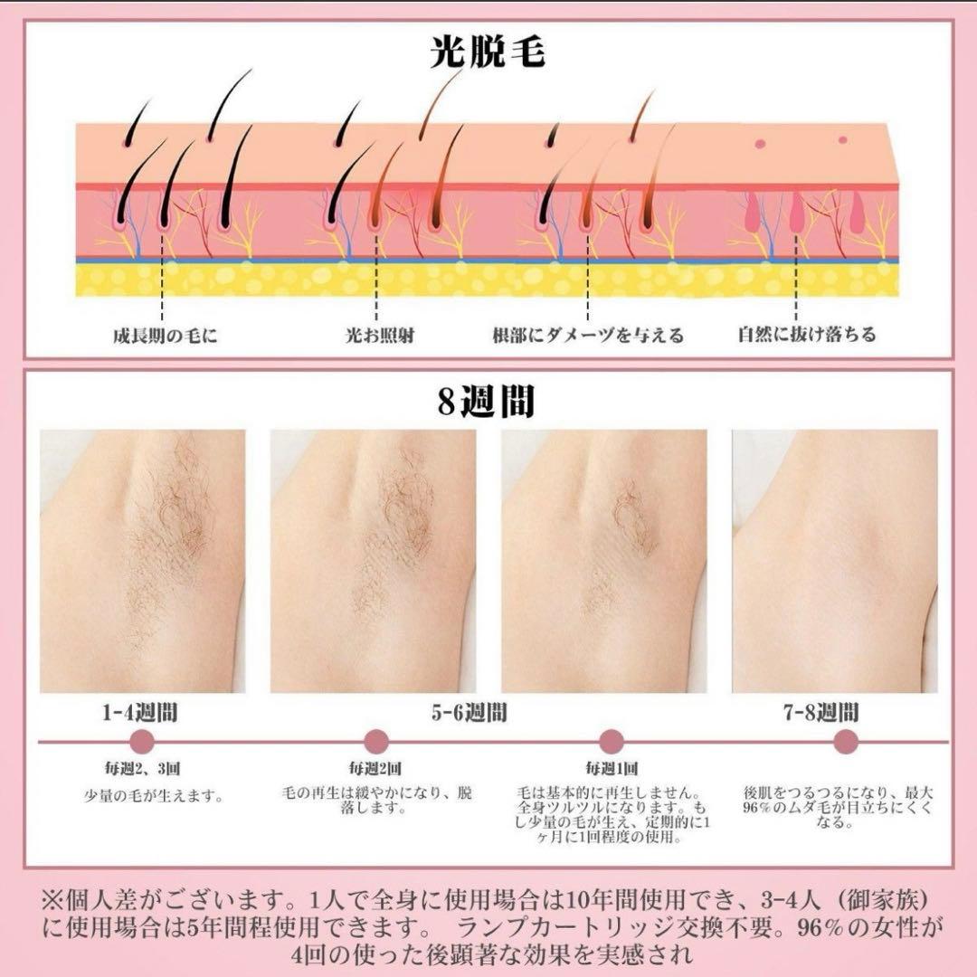 ✨1点限り✨脱毛器IPL hair removal device