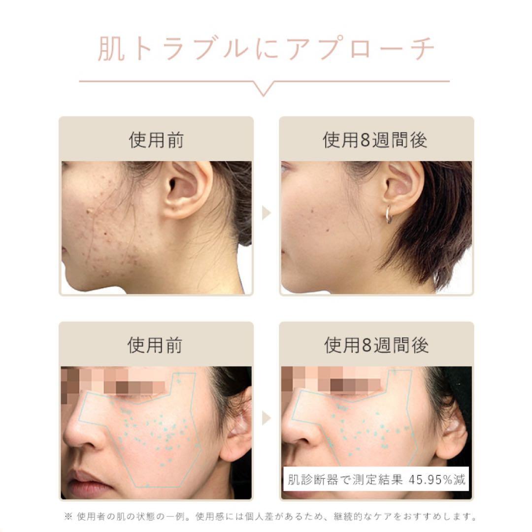 ステラボーテ 光美容器 脱毛器 Luna ルナ / ミルクティーベージュ